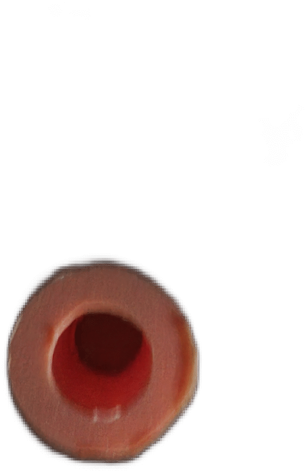 3d zahn_rohr ( - ;